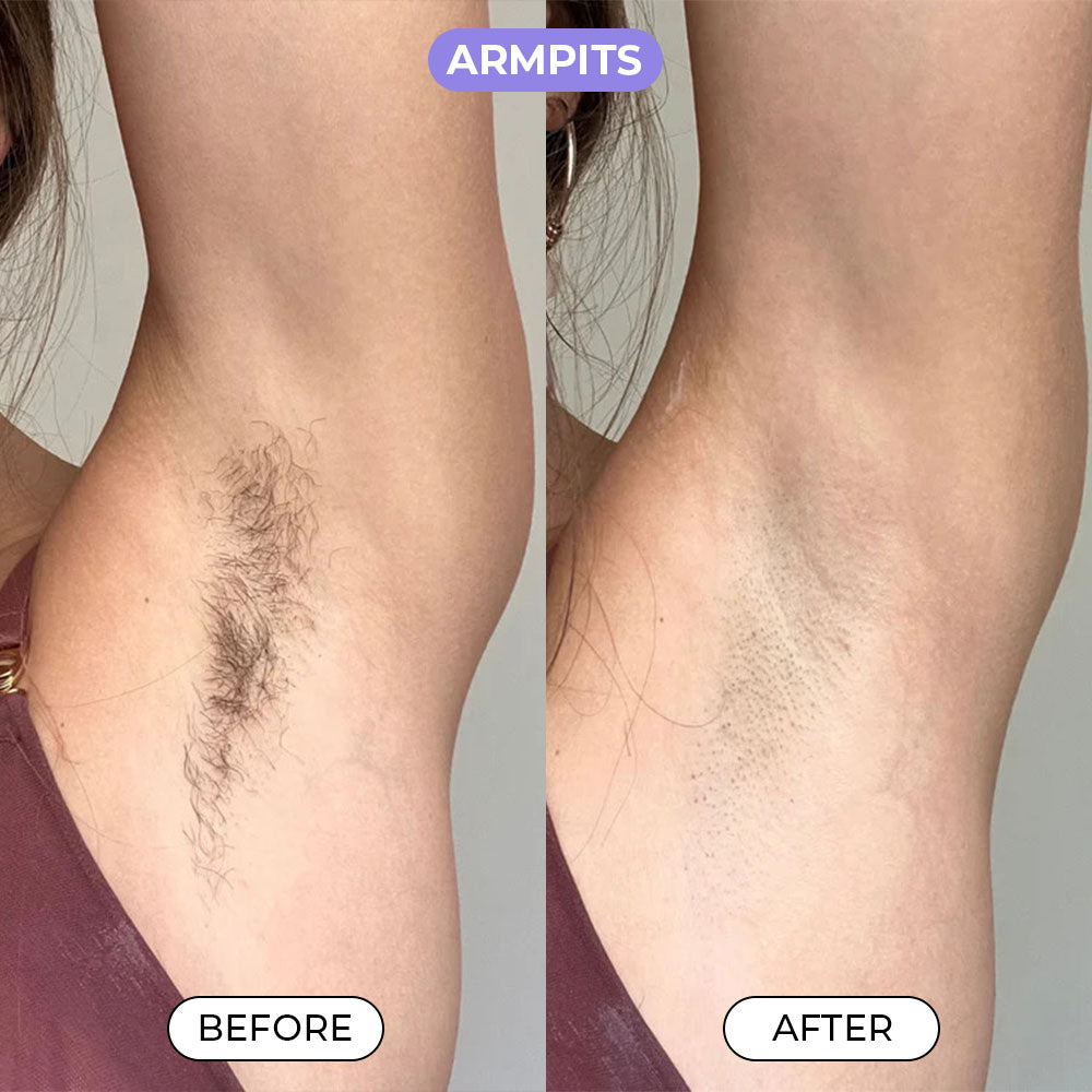 Body Hair Removal Cream