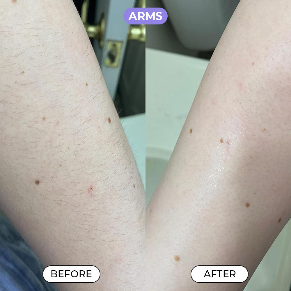 Body Hair Removal Cream