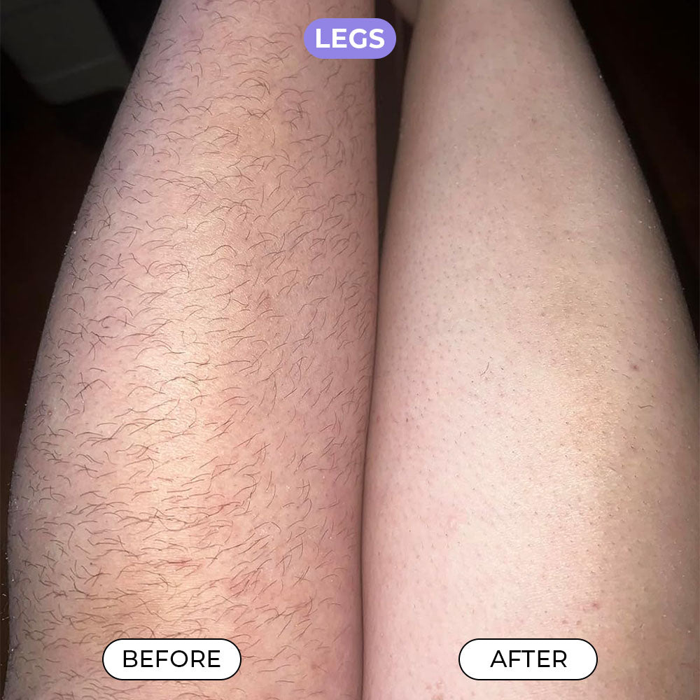 Body Hair Removal Cream
